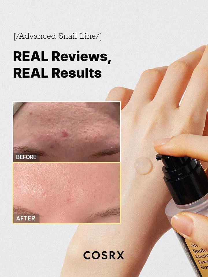COSRX Advanced Snail 96 Mucin Power Essence... - Image 3
